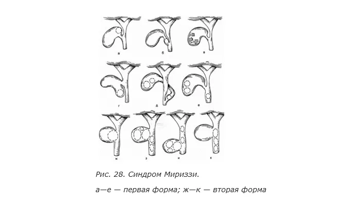 classification_i12